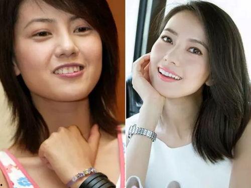 牙齿漂亮的女明星,揭秘牙齿亮丽的女明星美容秘诀