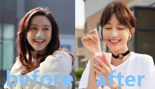 做过微整的明星,蜕变之路与公众目光